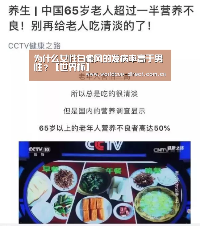 为什么女性白癜风的发病率高于男性?【世界杯】(图1) 2026世界杯
