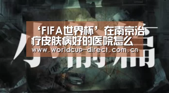 ‘FIFA世界杯’在南京治疗皮肤病好的医院怎么选(图2) 世界杯官网
